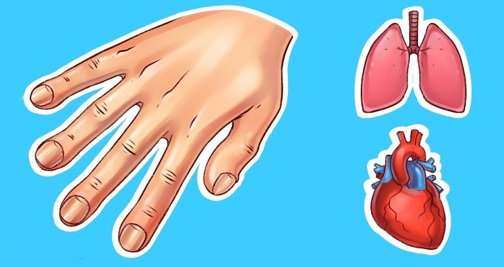 What Your Hands Say About Your Health-7 sign