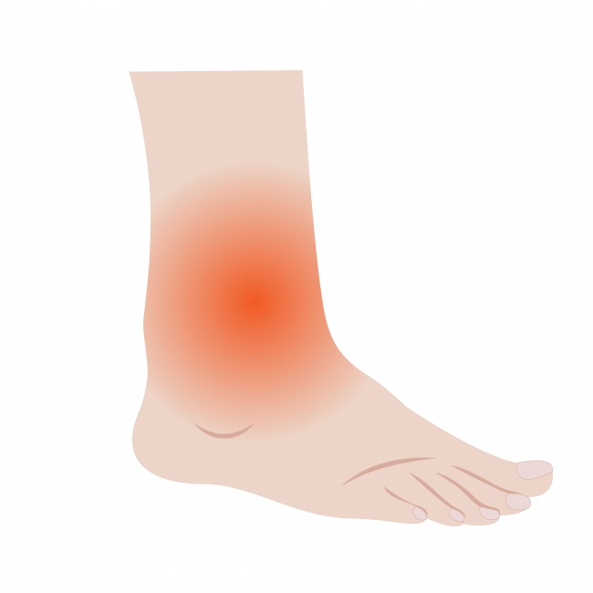 Swelling in ankles, feet and hands Kidney Symptoms