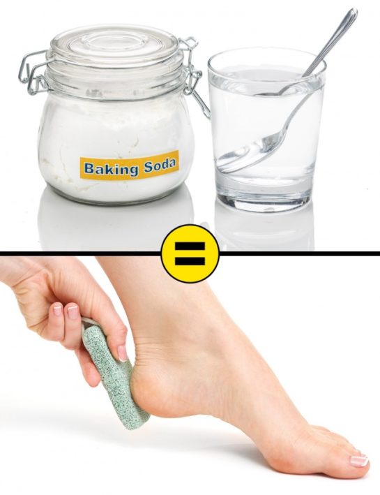 10 Home Remedies To Remove Cracked Heels And Get Beautiful Feet