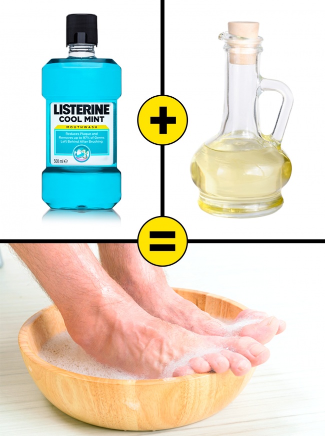 Listerine and vinegar