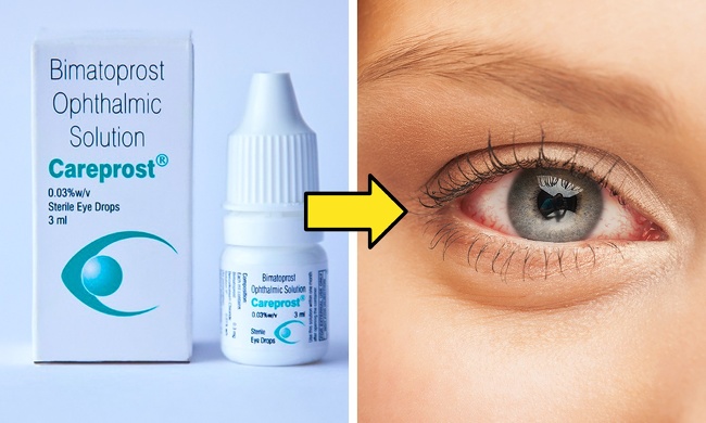 Careprost for eyelash growth