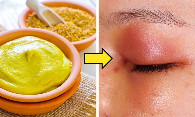 Mustard mask for hair growth
