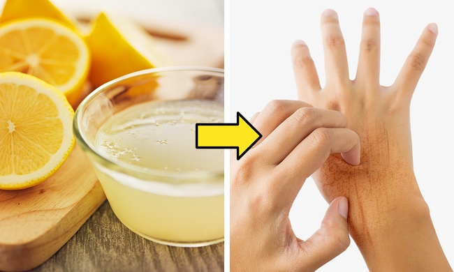 Warm oil with lemon juice for nail growth