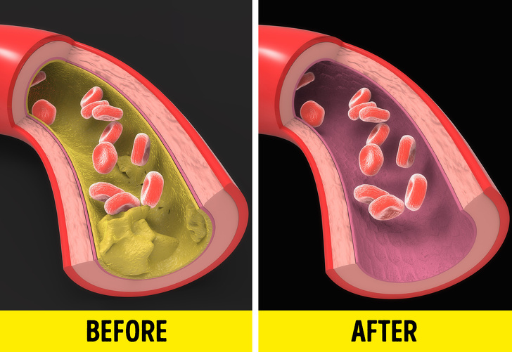 The risk of heart disease will decrease