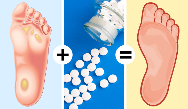 Aspirin as a callus remover