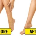 10 Natural Home Remedies Work Best To Irritation After Shaving