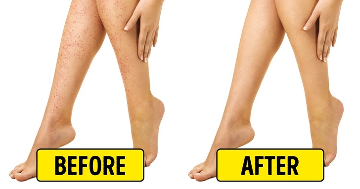 10 Natural Home Remedies Work Best To Irritation After Shaving