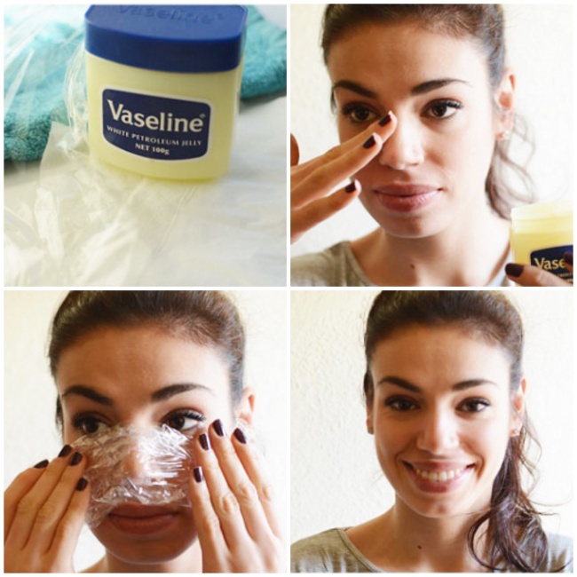 home remedy for blackheads and whiteheads