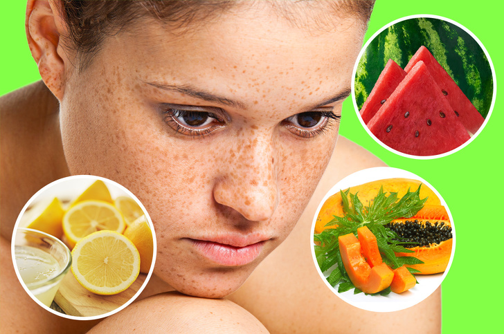 natural remedies to get rid of sunspots 