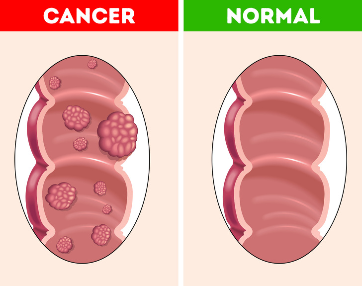 What Will Happen To Your Body If You Start Eating 3 Dates a Week