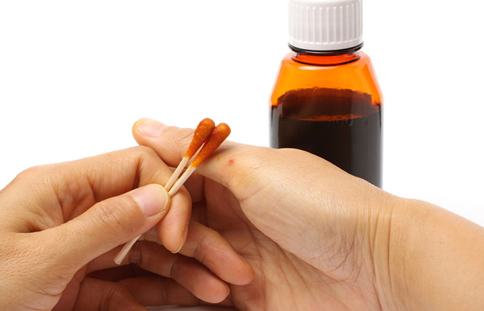 13 Natural Home Remedies For Mole Removal