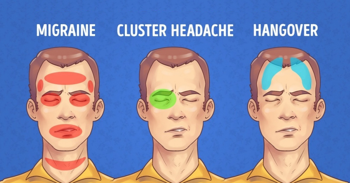 headache across forehead