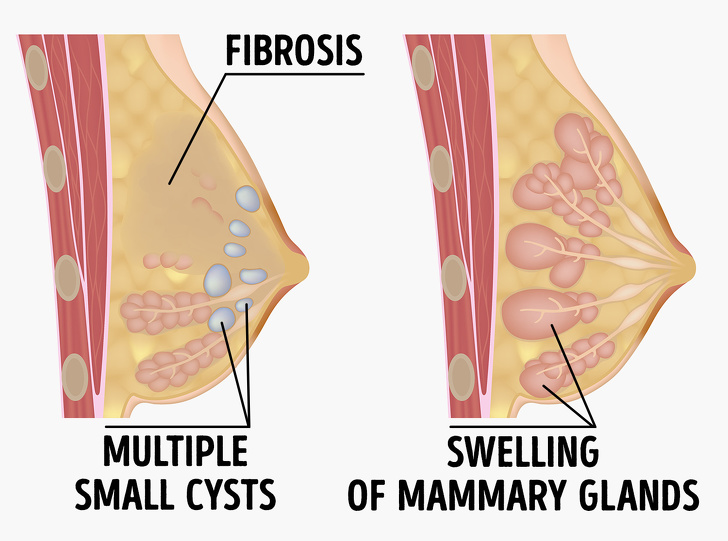 8 Symptoms Your Body Has Too Much Estrogen