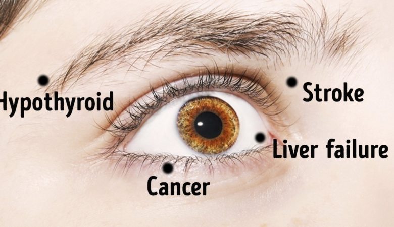 8 Things Your Eyes Say About Your Health