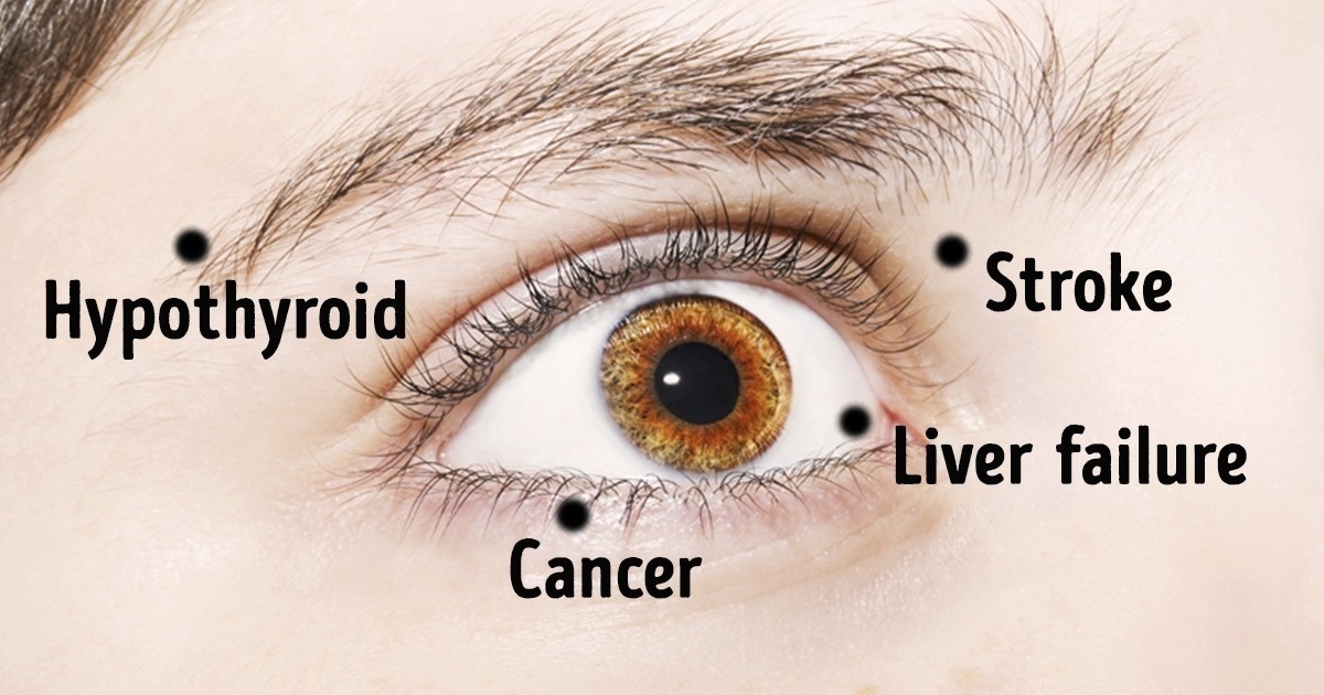 8-things-your-eyes-say-about-your-health