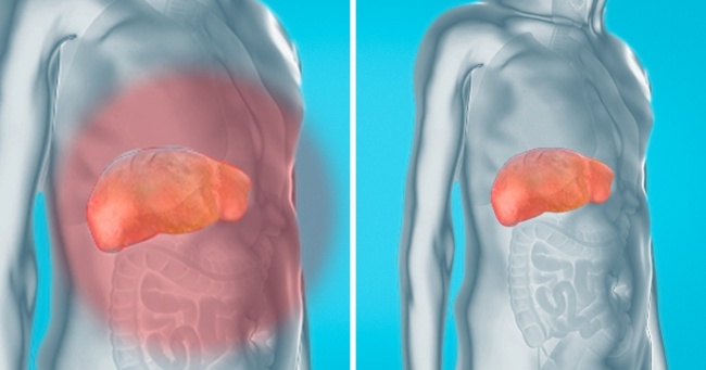 How to Remove Toxins From Your Liver and Kidneys Naturally