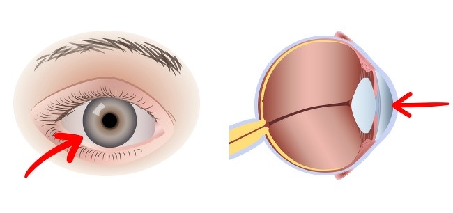 This Will Happen to Your Body If You Start Eating 2 Eggs a Day