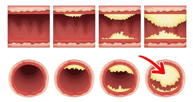 This Will Happen to Your Body If You Start Eating 2 Eggs a Day