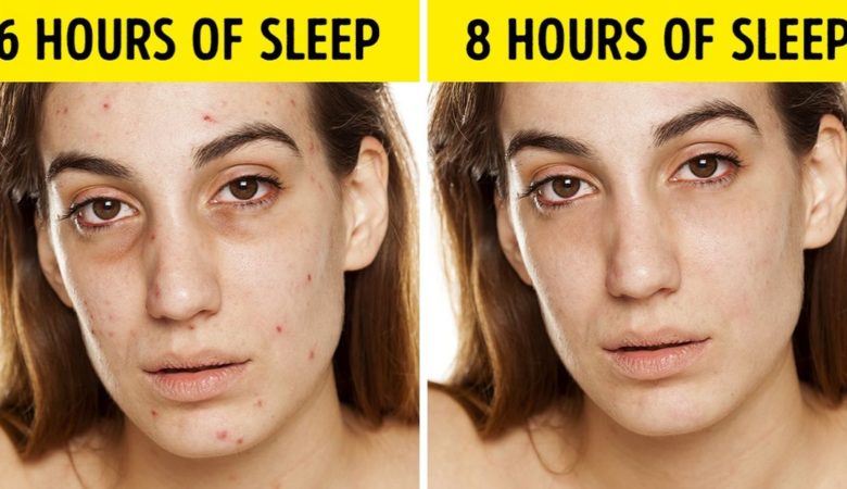 7 Thing Happens To Your Body When You Don’t Get Enough Sleep