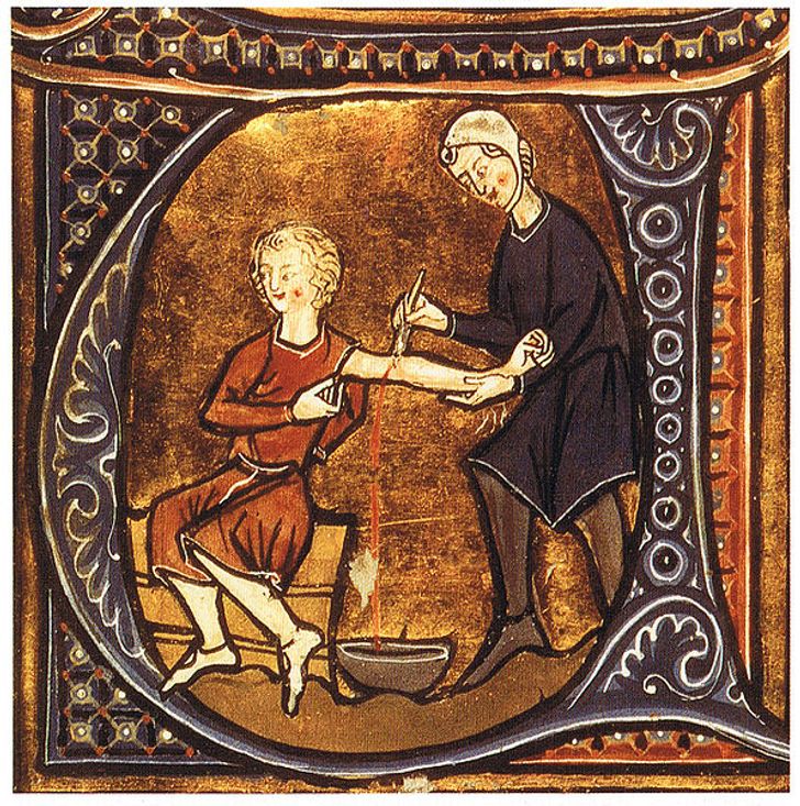 6 Unusual Ancient Medical Treatments That Should Stay in the Past Forever