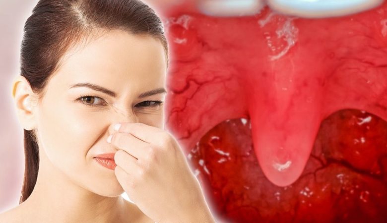 9 Surprising Daily Do’s and Don’ts to Avoid Bad Breath