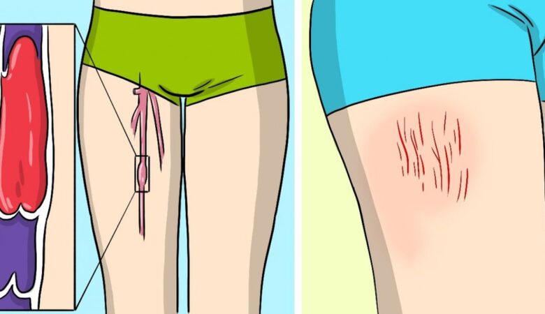 7 Warning Signs of a Blood Clot That Can’t Be Ignored