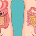 6 Natural Ways to Cleanse Your Colon and Preserve Your Youth