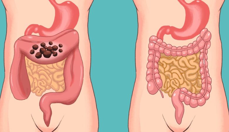 6 Natural Ways to Cleanse Your Colon and Preserve Your Youth