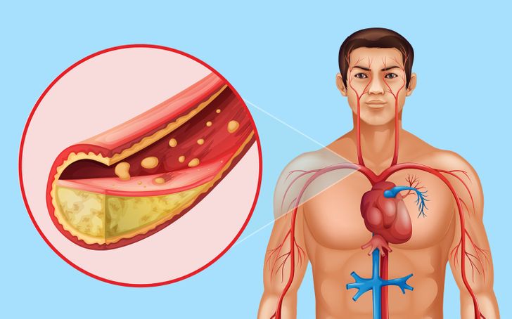 This Will Happen to Your Body If You Eat Flaxseed Every Day