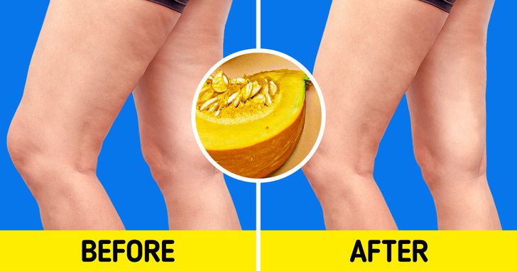 7 Foods That May Help You Fight Cellulite