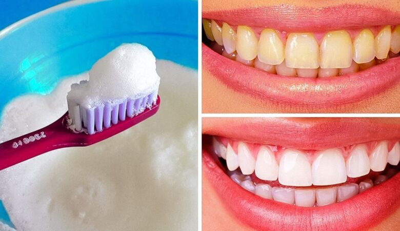 8 Simple Ways to Naturally Whiten Your Teeth at Home