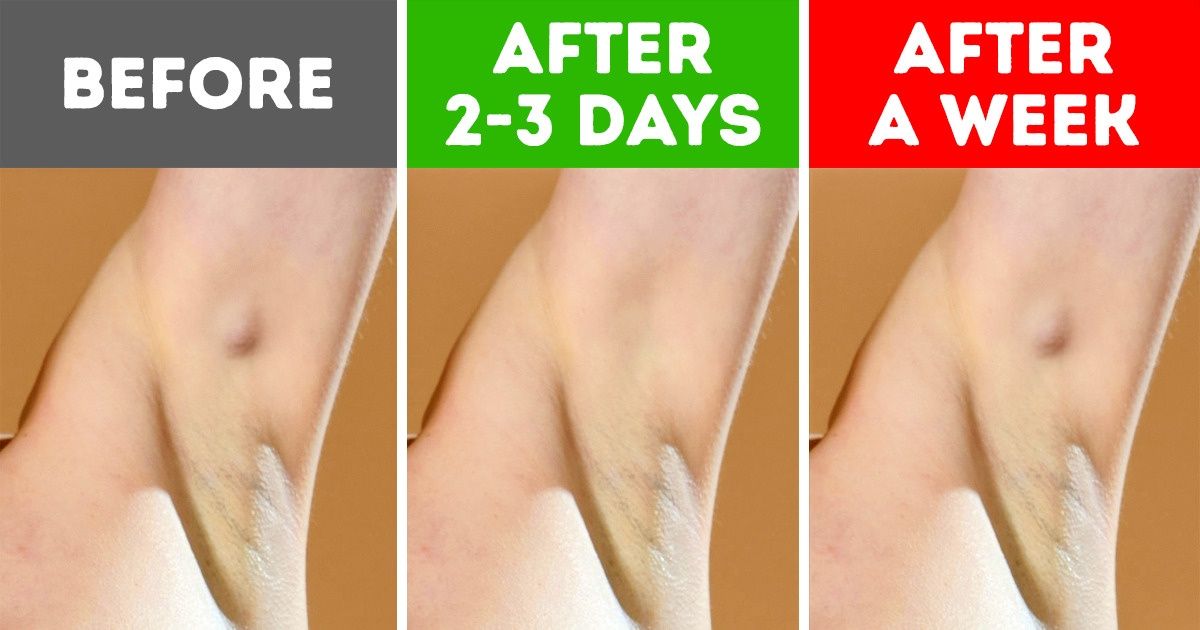 6 Not So Known Armpit Signals That Can Indicate Health Issues