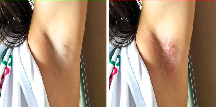 6 Not So Known Armpit Signals That Can Indicate Health Issues