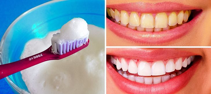 8 Simple Ways to Naturally Whiten Your Teeth at Home