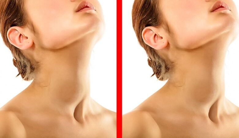 6 Symptoms of Thyroid Disease You Mustn’t Ignore