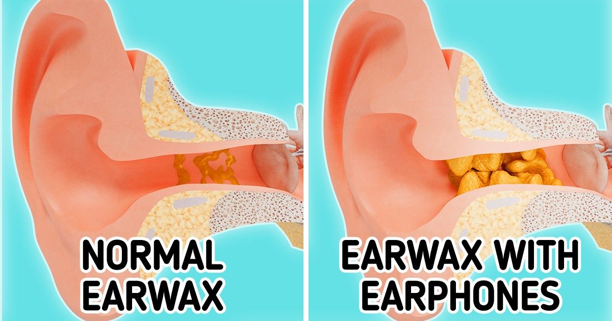What Happens to Your Body When You Wear Headphones for Too Long
