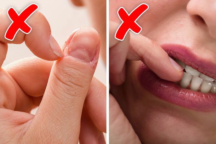 5 Things Your Nail Biting Habit Can Reveal About You