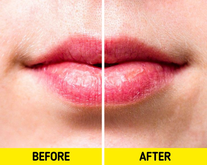 What Happens to Your Lips When You Use Lip Balm Too Often