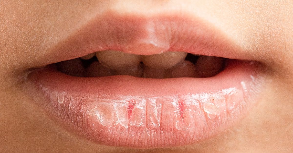 What Happens To Your Lips When You Use Lip Balm Too Often What Happens To Your Lips When You Use Lip Balm Too Often