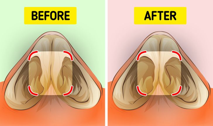 Why Picking Your Nose Is Not Only Indecent But Can Also Be Harmful