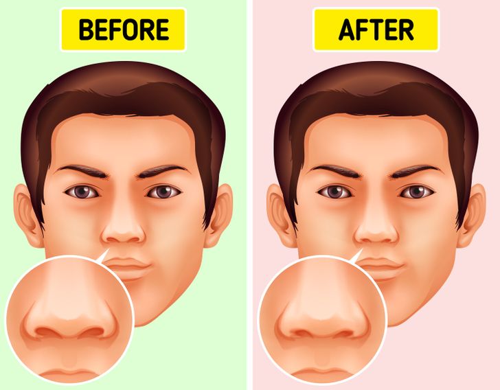 Why Picking Your Nose Is Not Only Indecent But Can Also Be Harmful