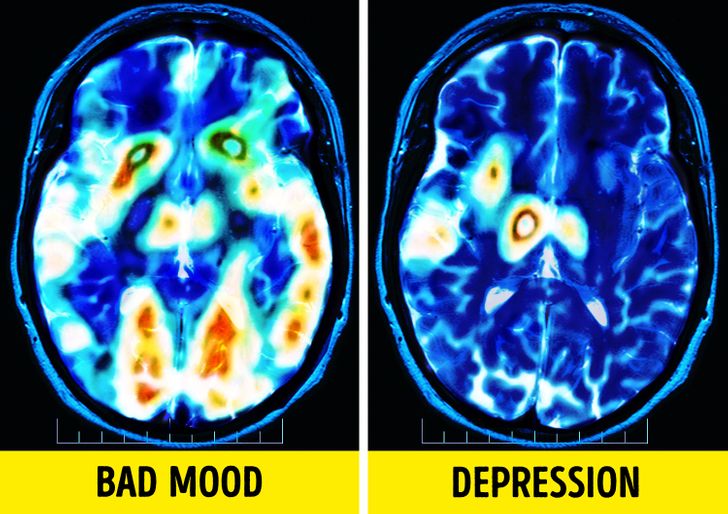 Why the World Sees Less and Less “Normal” People These Days