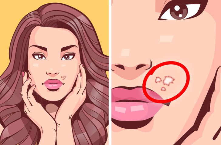 6 non-obvious things that can happen if you bite your nails