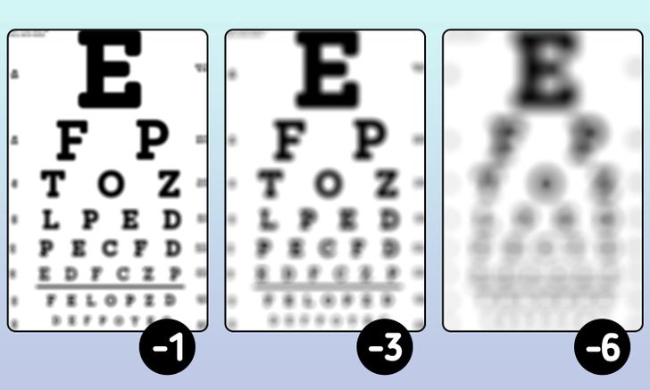 How People With Different Degrees and Causes of Impaired Vision Actually See the World