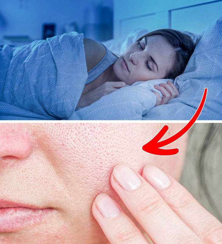 What Can Happen to Your Skin If You Start Sleeping Without a Pillow