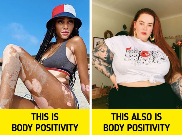 Why Body Positivity Doesn’t Actually Promote Obesity