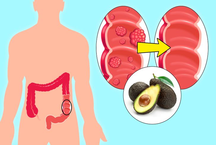 What Can Happen to Your Body If You Start Eating an Avocado a Day for 30 Days