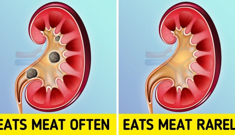 What Happens to Your Body When You Eat Too Much Meat