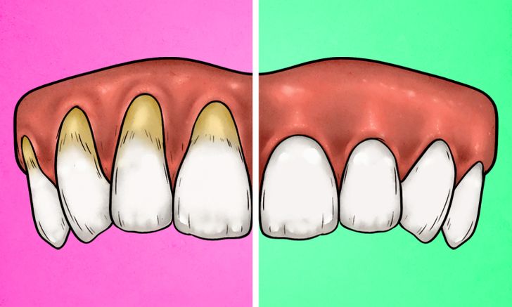 4 Signs You’re Brushing Your Teeth Too Hard, and 4 Ways You Can Fix It