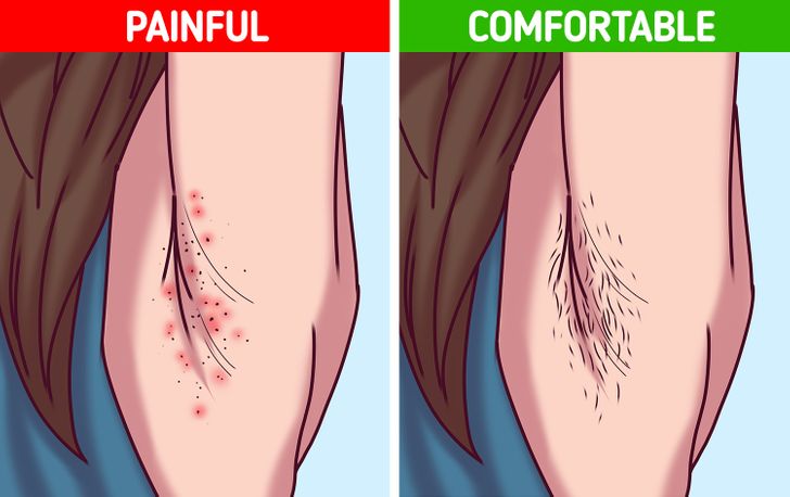 6 Reasons Why Accepting Your Body Hair Can Upgrade Your Life